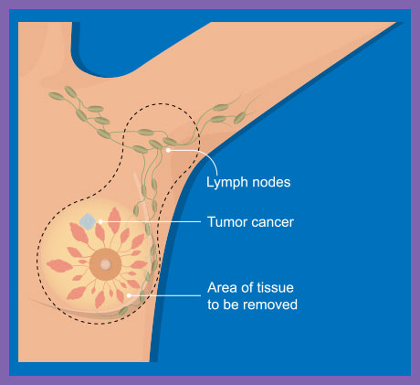 diagram of the breast